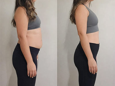Medical-Weight-Management